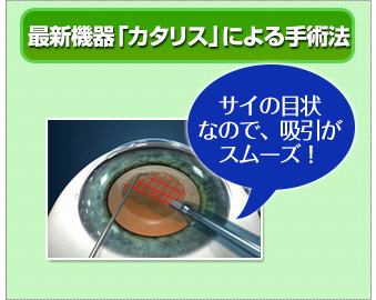 最新機器カタリスによる手術法