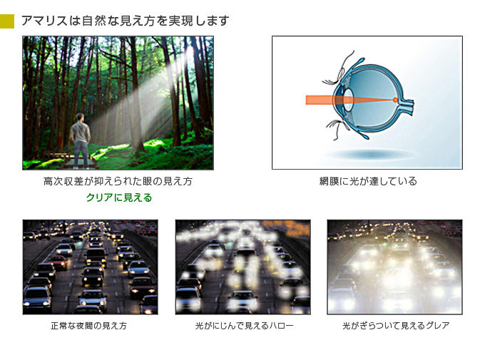 高次収差が抑えられた眼の見え方→クリアに見える（網膜に光が達しているから）