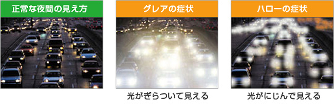 ハロー・グレアの症状イメージ