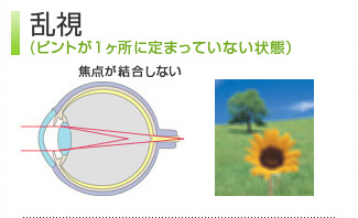 乱視（ピントが1ヶ所に定まっていない状態）