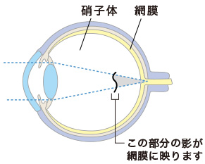 硝子体、網膜、この部分の影が網膜に映ります