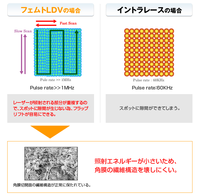 フェムトLDVはレーザーが照射される部分が重ぶくするので、スポットに隙間が生じない為、フラップリフトが容易にできる。また、照射エネルギーが小さいため、角膜の繊維構造を壊しにくい。その結果、角膜切開面の繊維構造が正常に保たれている。例えばイントラレースの場合、スポットに隙間ができてしまう。