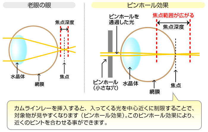 カムラインレーを挿入すると、入ってくる光を中心近くに制限することで、対象物が見やすくなります(ピンホール効果)。このピンホール効果により、近くのピントを合わせる事ができます。