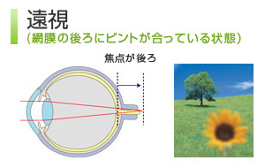 遠視